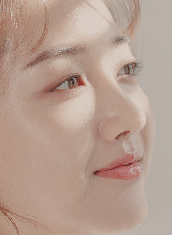 눈성형 이미지