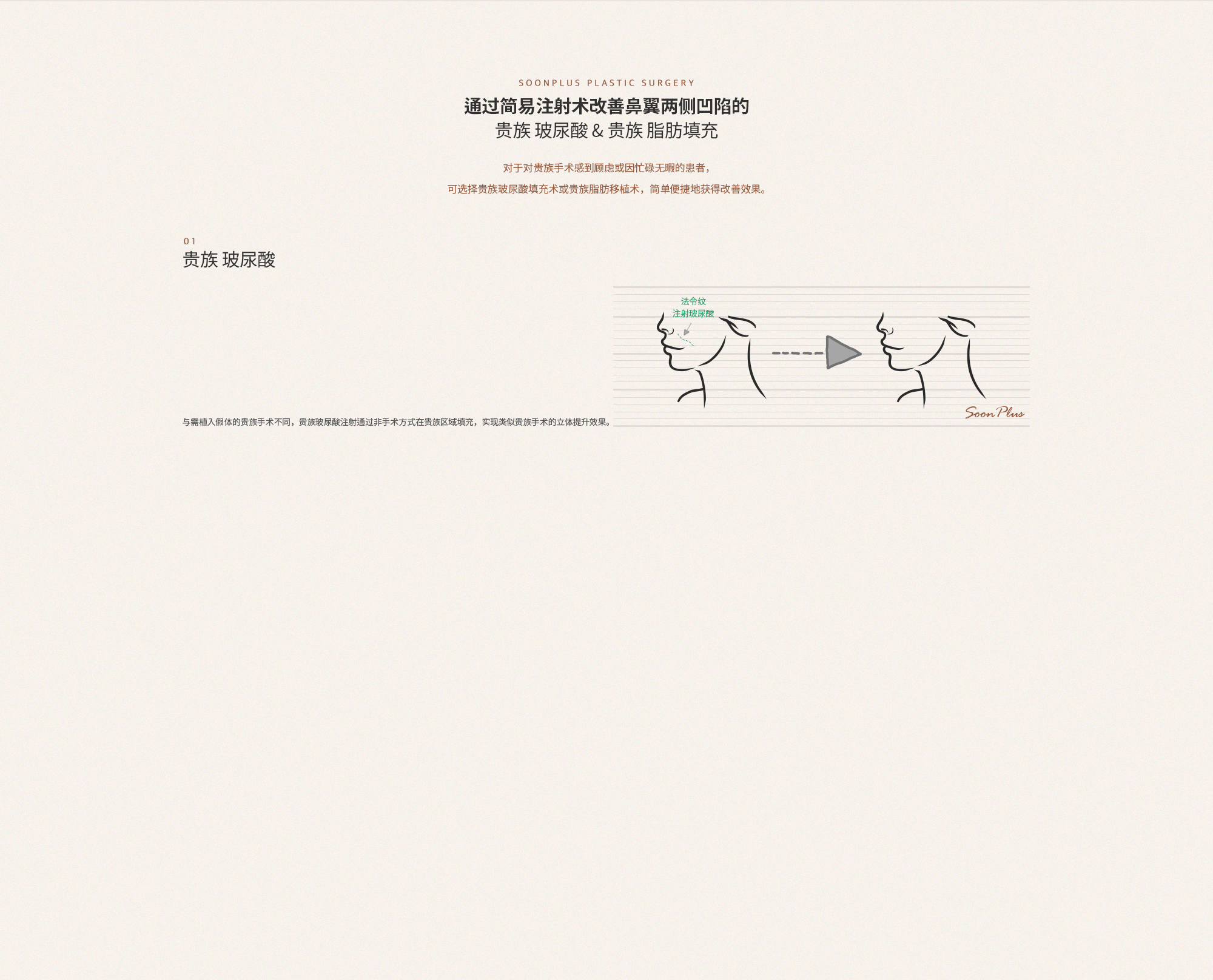 01 귀족 필러