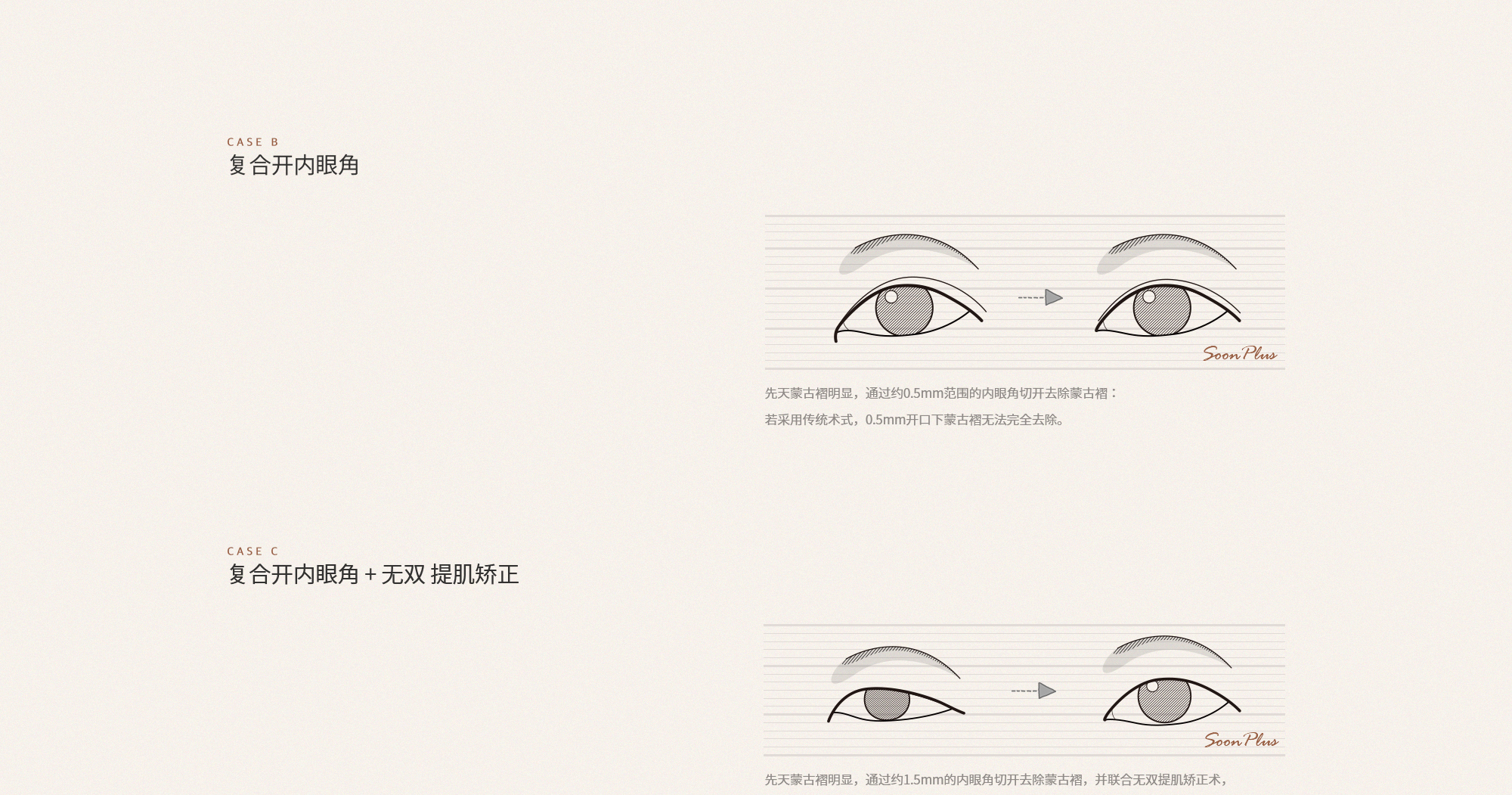 sub_1