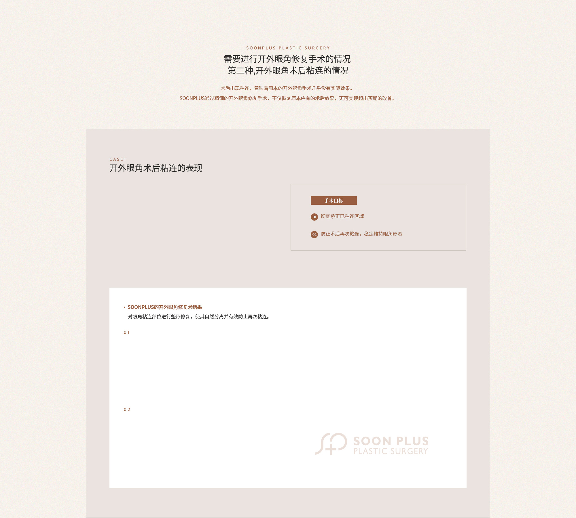 두번째, 뒤트임이 붙어버린 경우