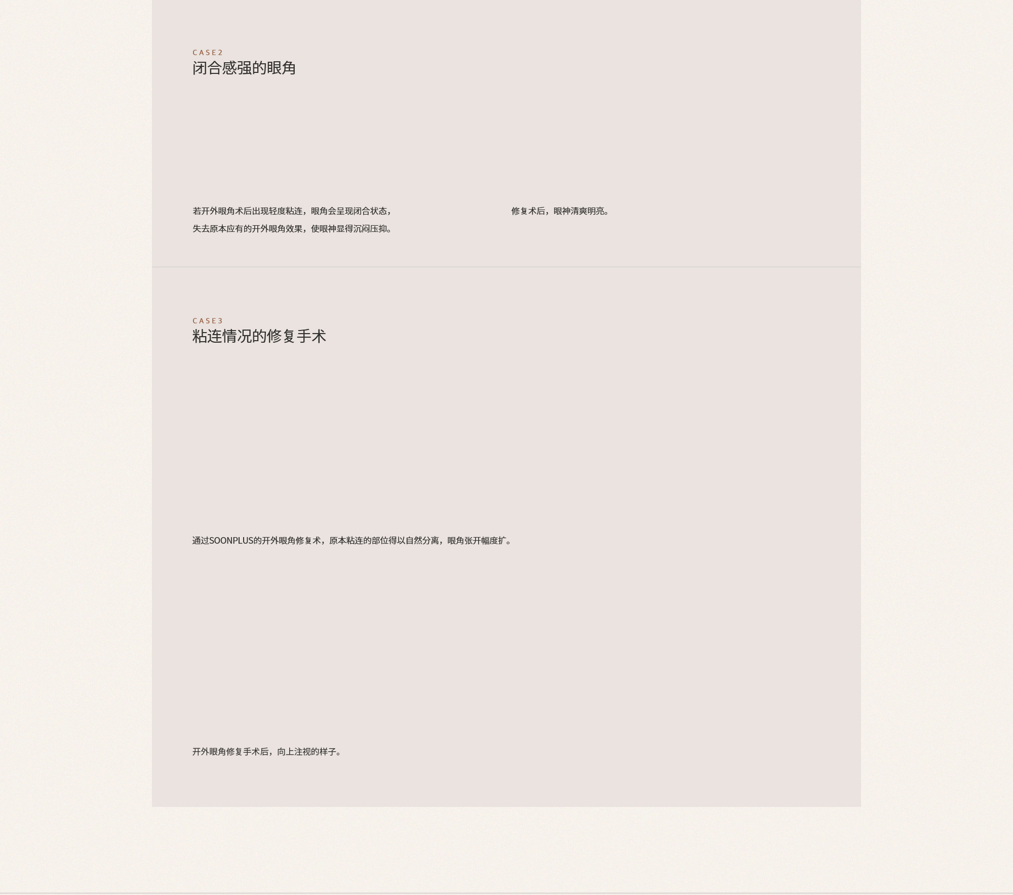 뒤트임이 붙는다는 건 뒤트임 수술을 할 필요가 없었다는 것이나 마찬가지입니다.
