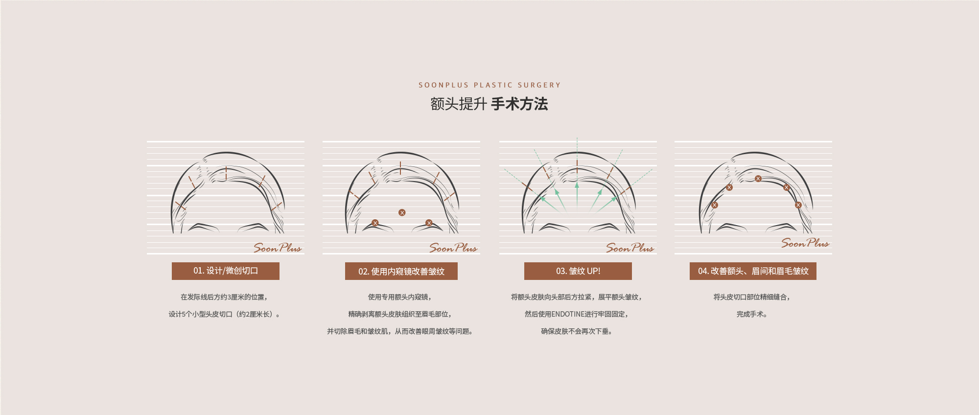이마거상