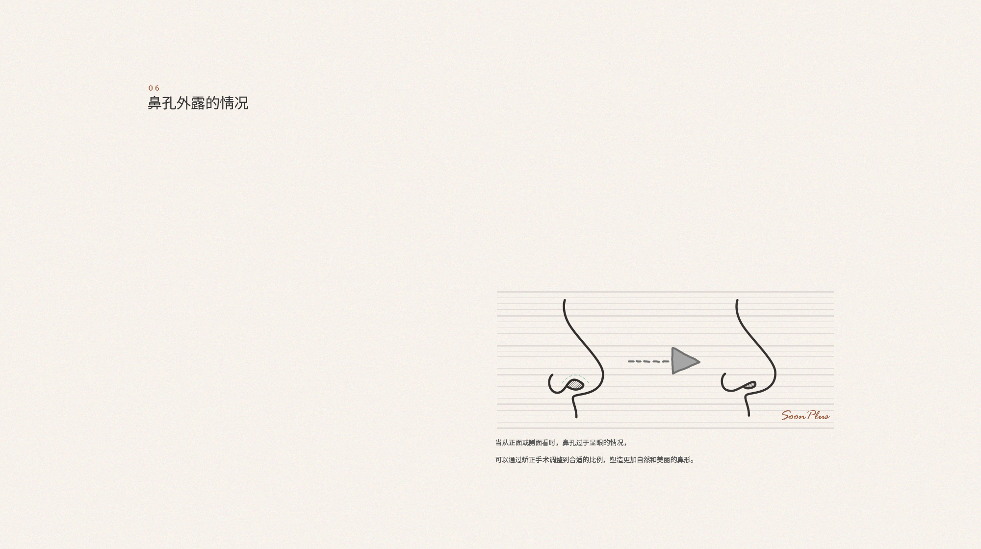 06 콧구멍이 보이는 경우