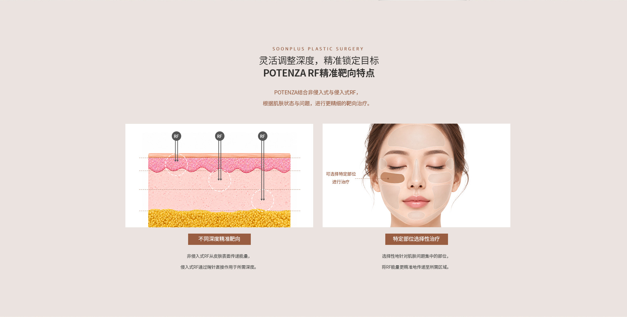 可调节深度、精准靶向的POTENZA射频特点。